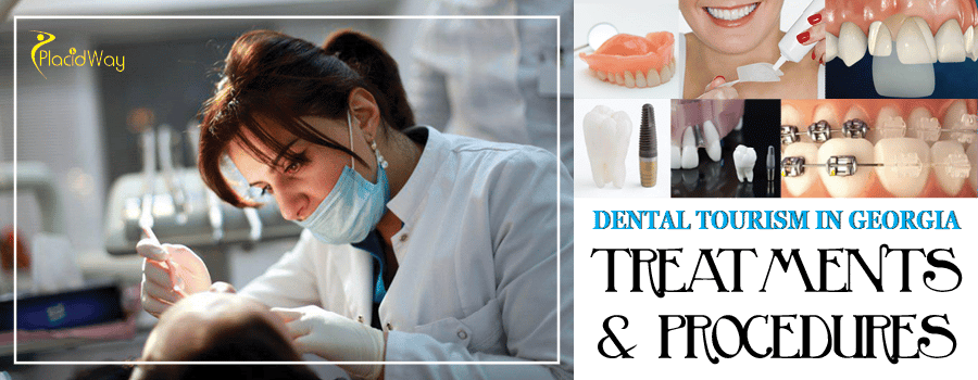 Dental Treatments in Tbilisi, Georgia